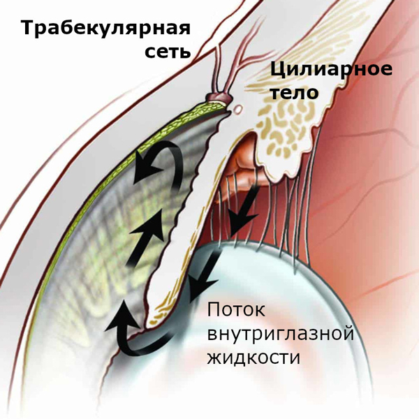 Лечение глаукомы (СЛТ)